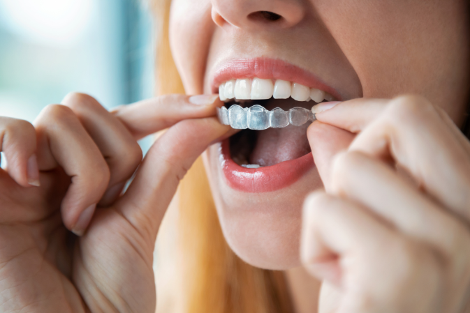 Estética dental