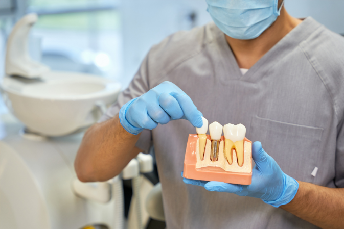 Implantes y cirugía oral